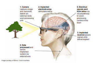 Illustration for article titled Bionic Eyes Are Totally a Thing Come 2013